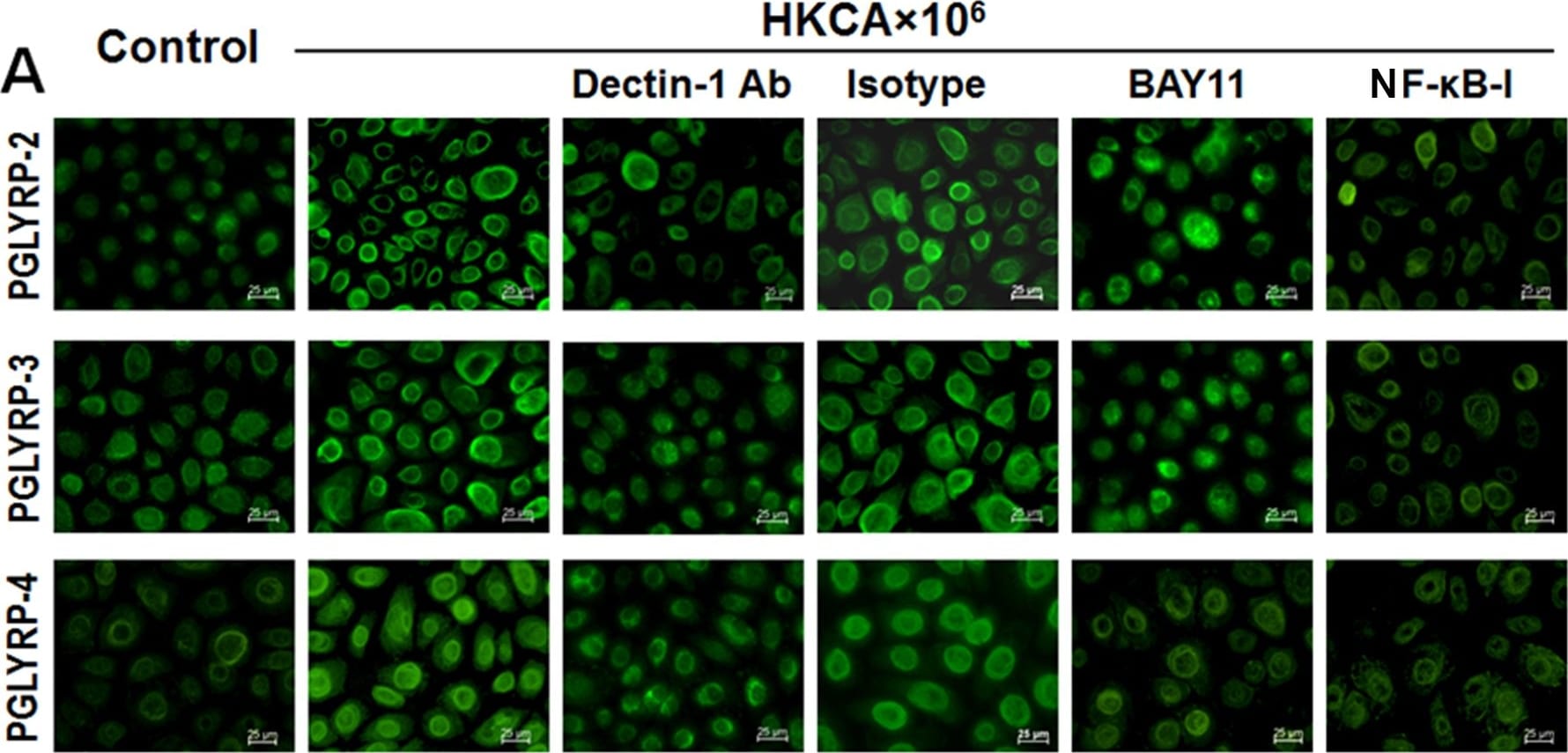 PGLYRP4/PGRP-I beta Antibody (186C426)