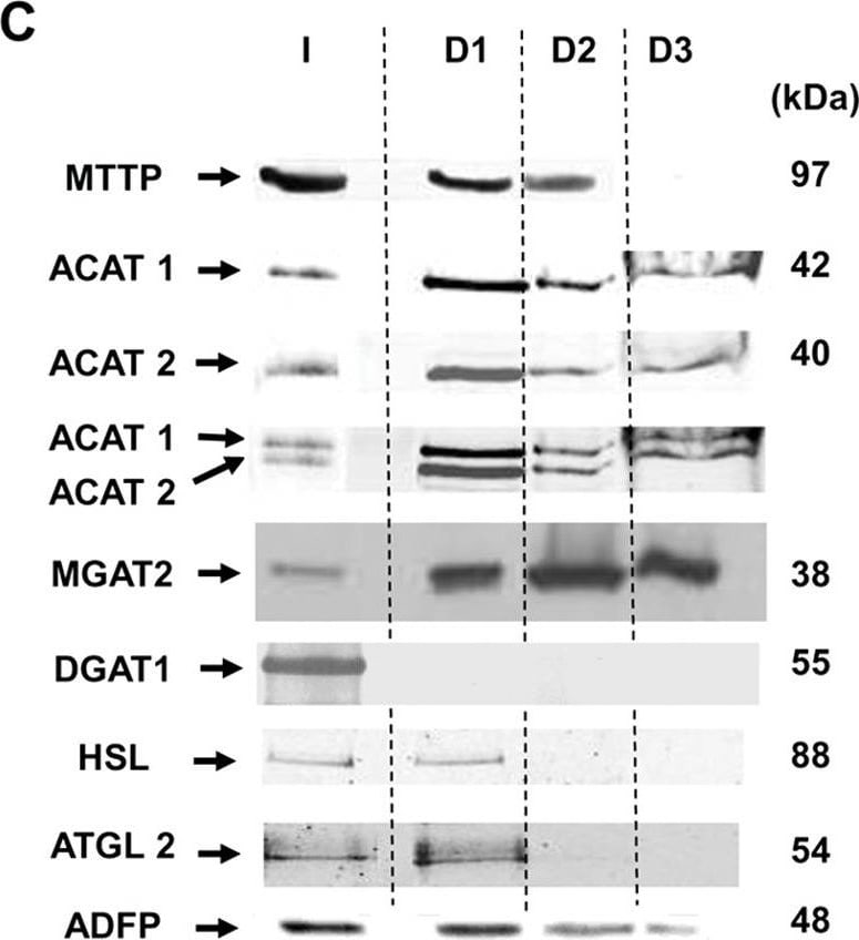 DGAT1 Antibody