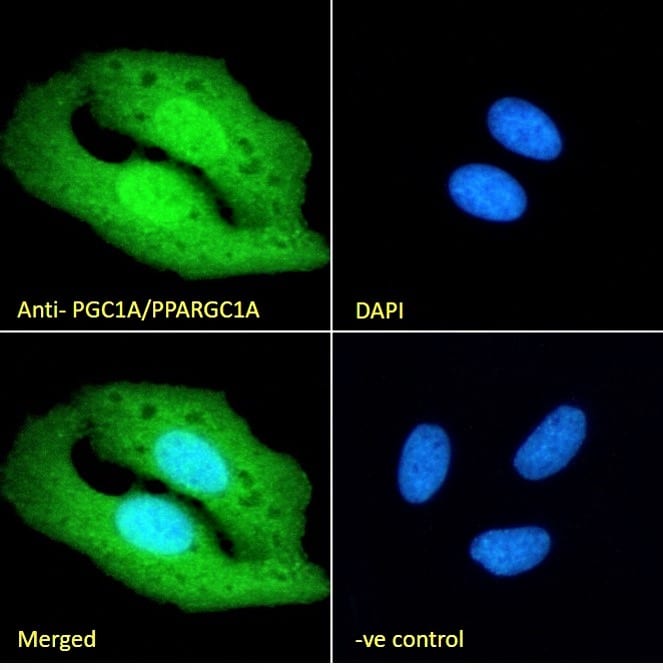 PGC1 alpha Antibody