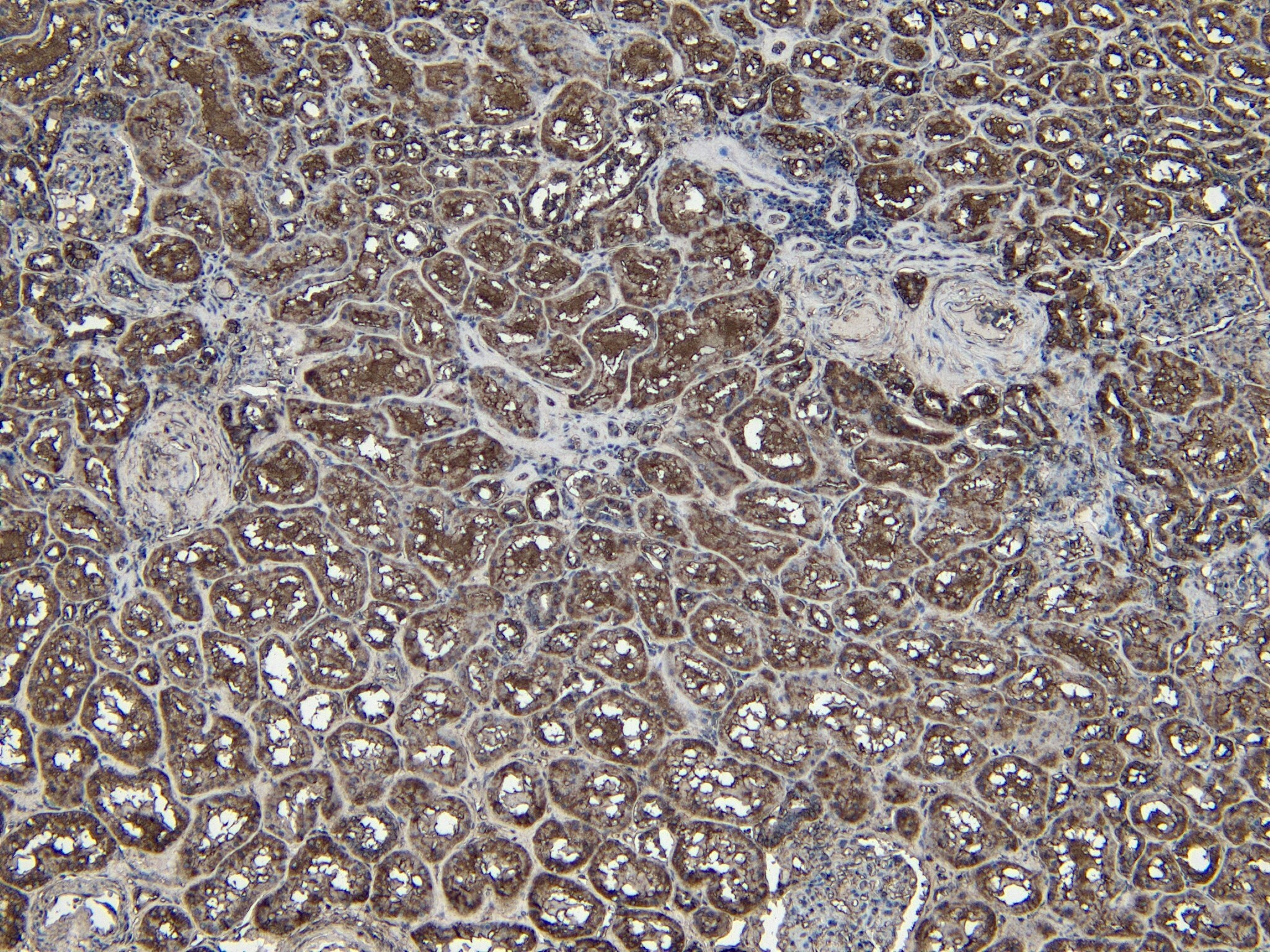 PGC1 alpha Antibody