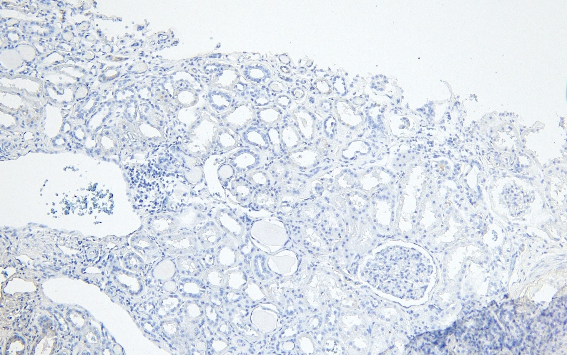 PGC1 alpha Antibody