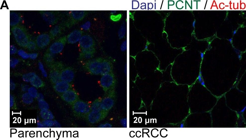 Pericentrin Antibody - BSA Free