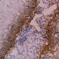 Integrin beta 4/CD104 Antibody (450-9D) [FITC] Immunohistochemistry: Integrin beta 4/CD104 Antibody (450-9D) [FITC] - [NB100-63326] -