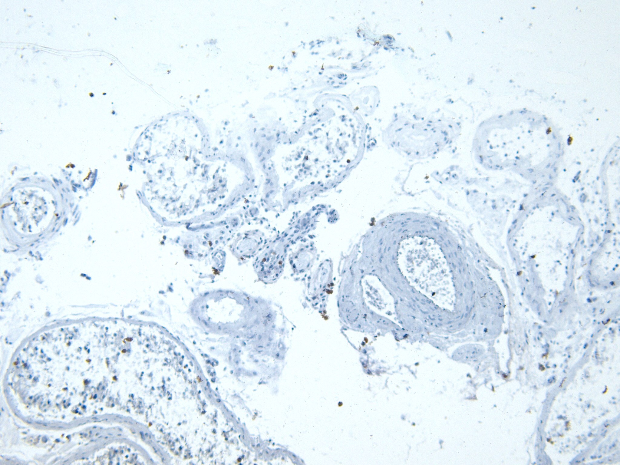 Lactate Dehydrogenase C Antibody