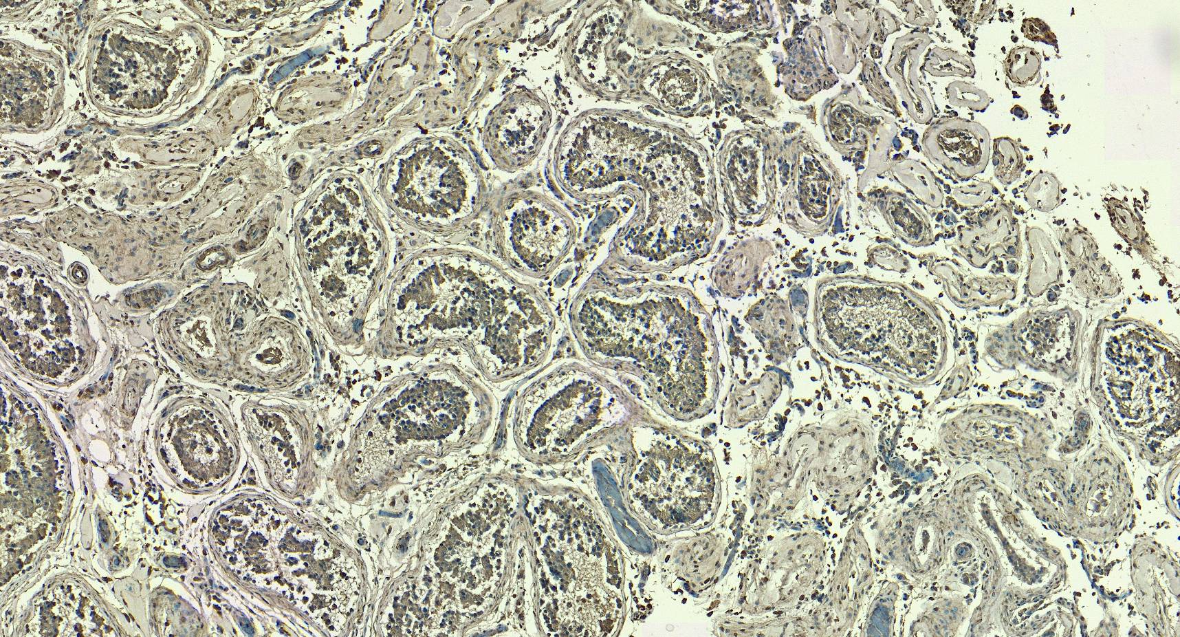 Lactate Dehydrogenase C Antibody