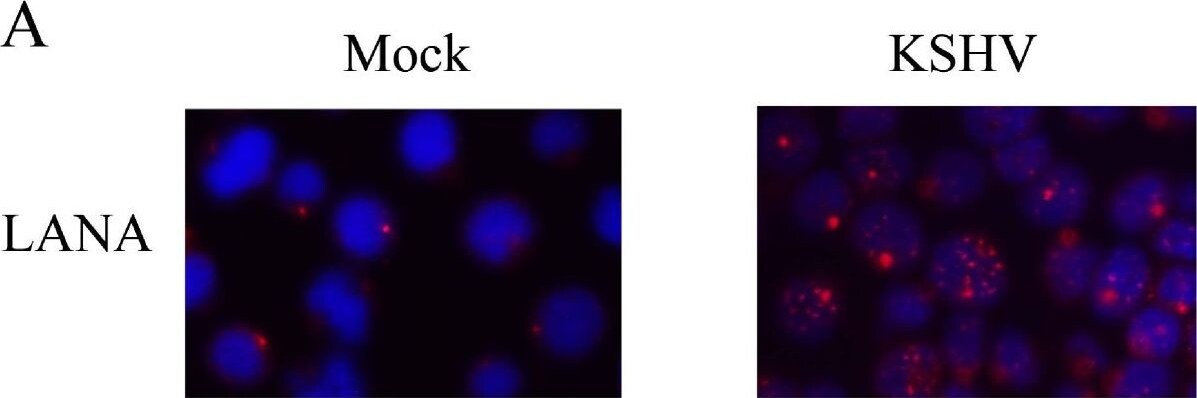 ORF73/HHV8 Antibody (4C11) - BSA Free