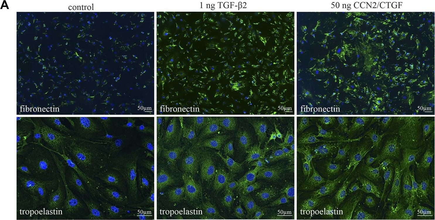 CTGF/CCN2 Antibody