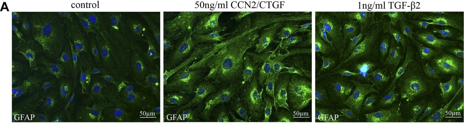 CTGF/CCN2 Antibody