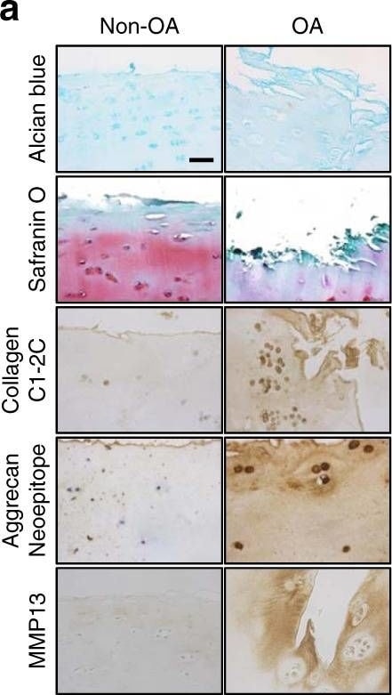 Aggrecan Neoepitope Antibody - BSA Free