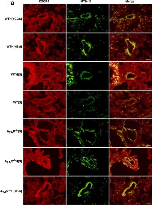 CXCR4 Antibody