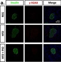 Histone H2AX [p Ser139] Antibody (3F2)