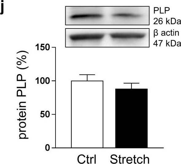 Myelin PLP Antibody