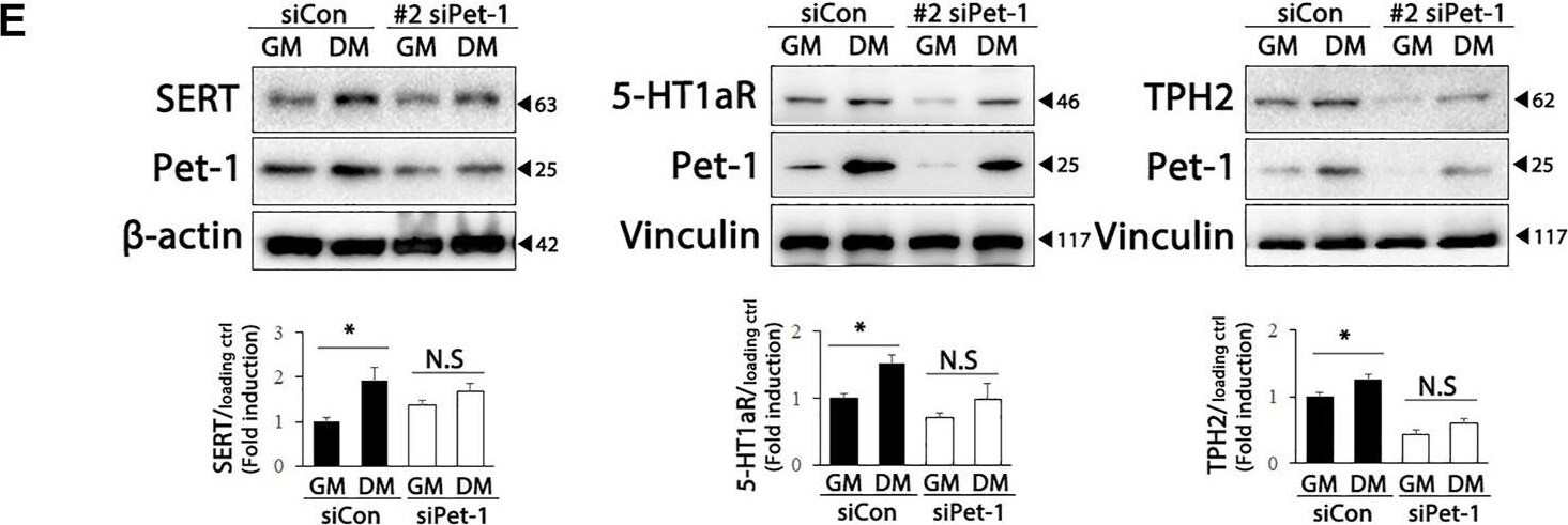 Tryptophan hydroxylase 2 Antibody - BSA Free