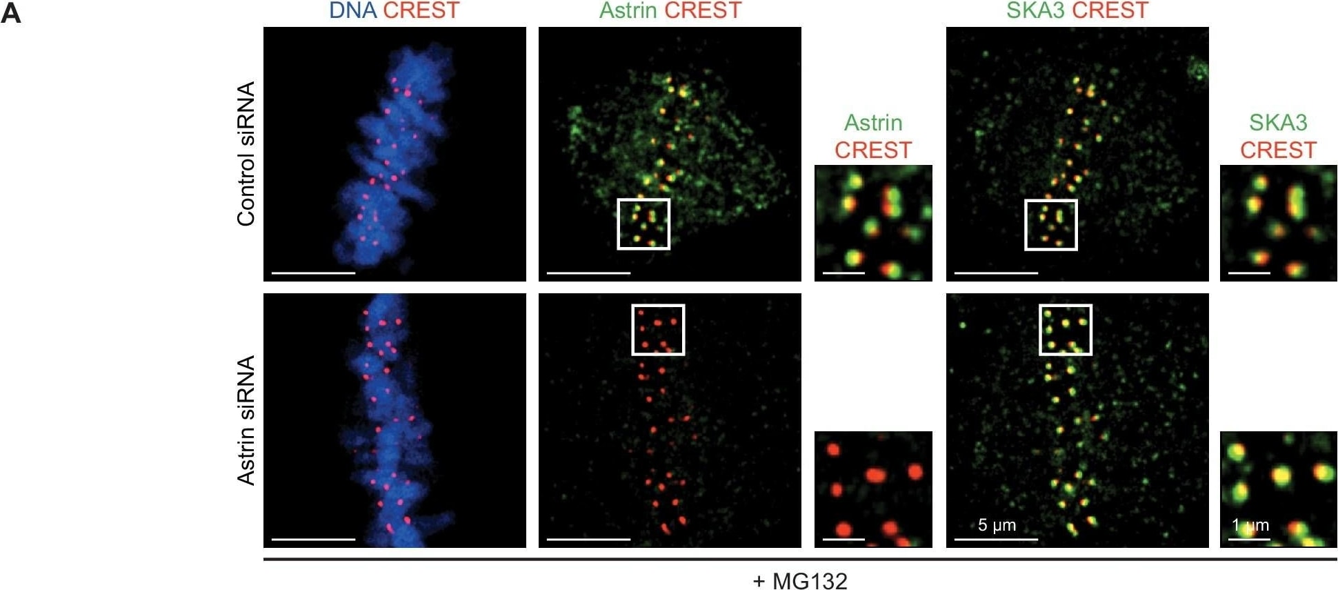 Astrin Antibody