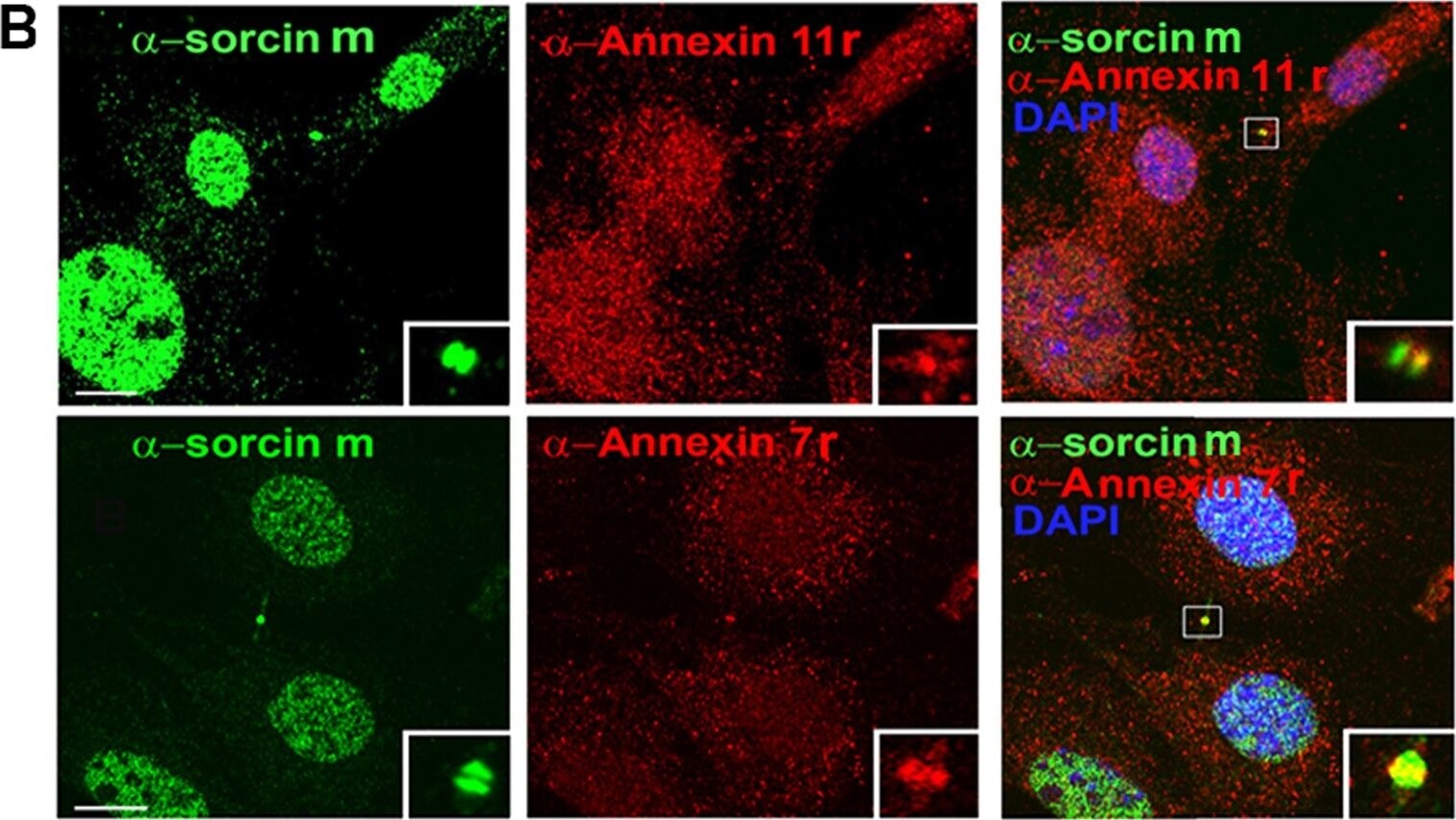 Annexin A11 Antibody - BSA Free