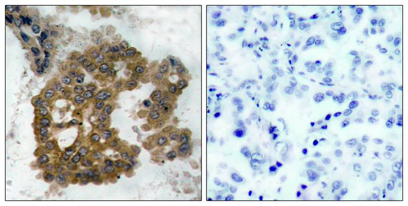 AKT2 [p Ser474] Antibody - BSA Free