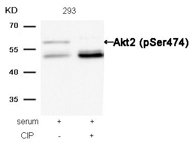 AKT2 [p Ser474] Antibody - BSA Free