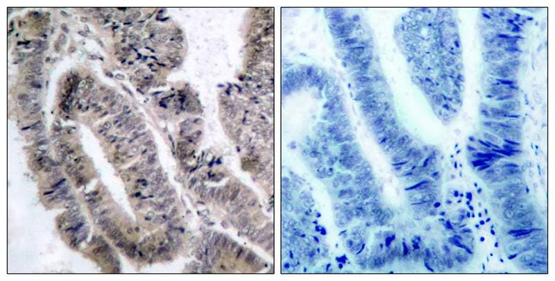AMPK alpha 1 [p Ser496] Antibody