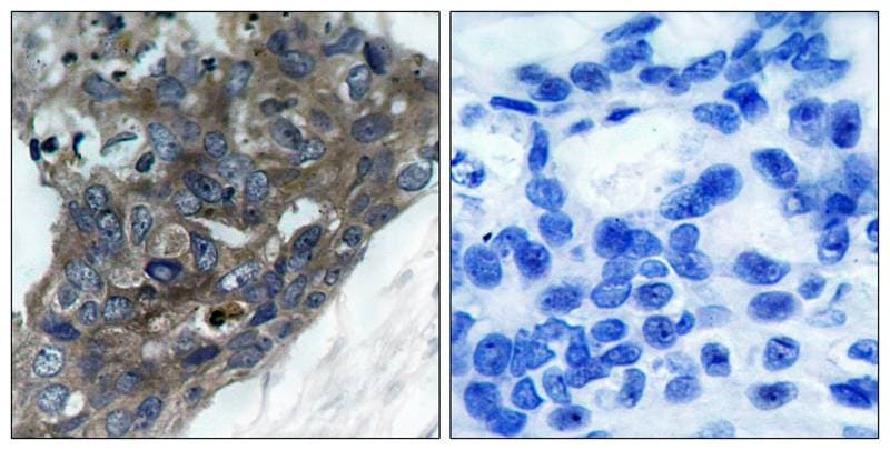 ASK1 Antibody - BSA Free