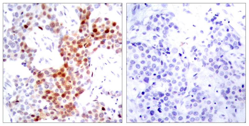 ATF2 [p Thr69] Antibody - BSA Free