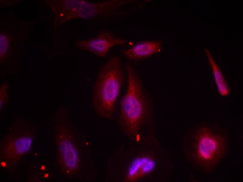 ATF2 [p Thr69] Antibody - BSA Free