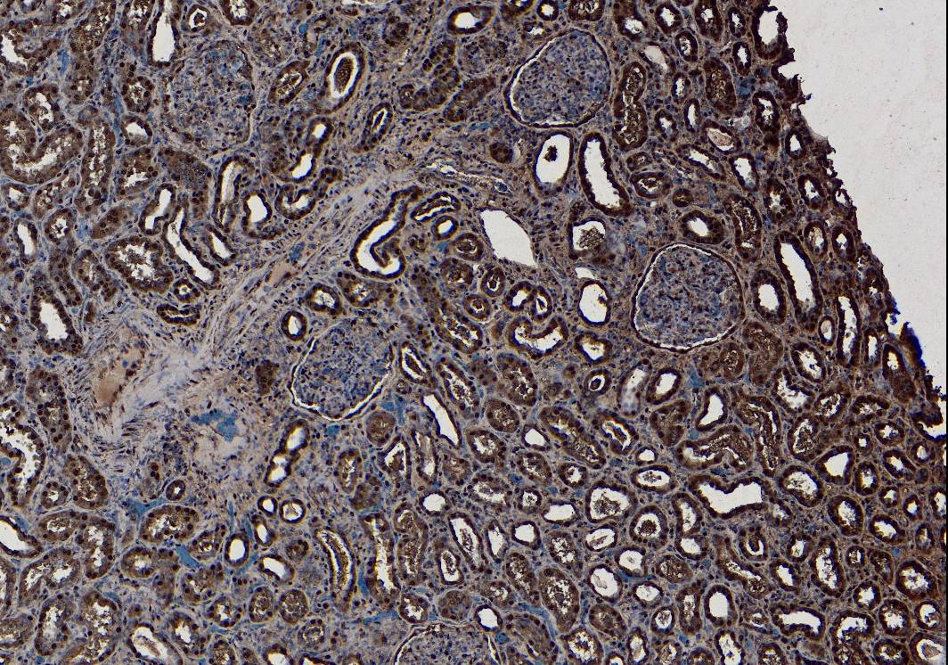 SET Antibody