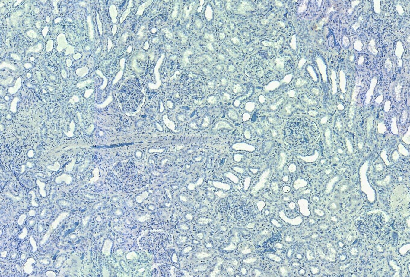 SET Antibody
