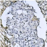 ATF4 [p Ser245] Antibody