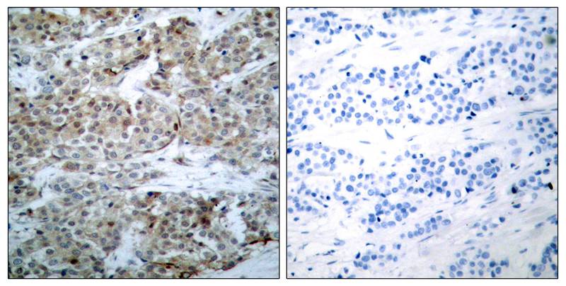 Bad [p Ser112] Antibody - BSA Free