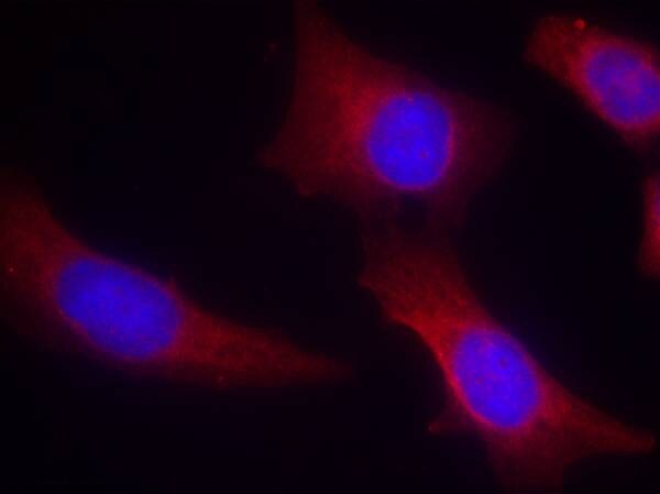 CaM Kinase II alpha Antibody - BSA Free
