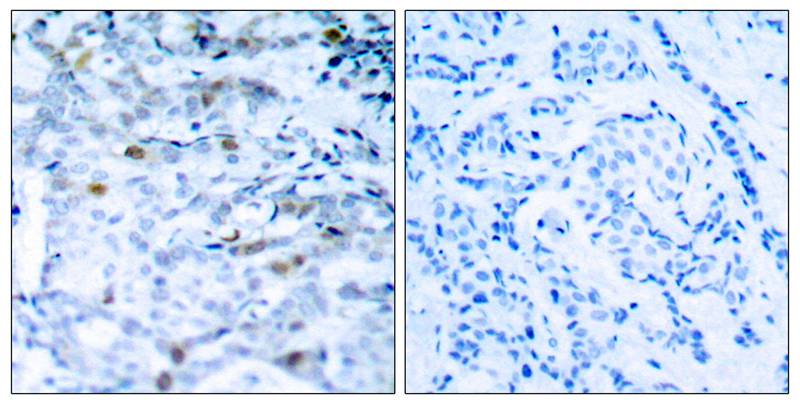 CDC2/CDK1 [p Thr161] Antibody