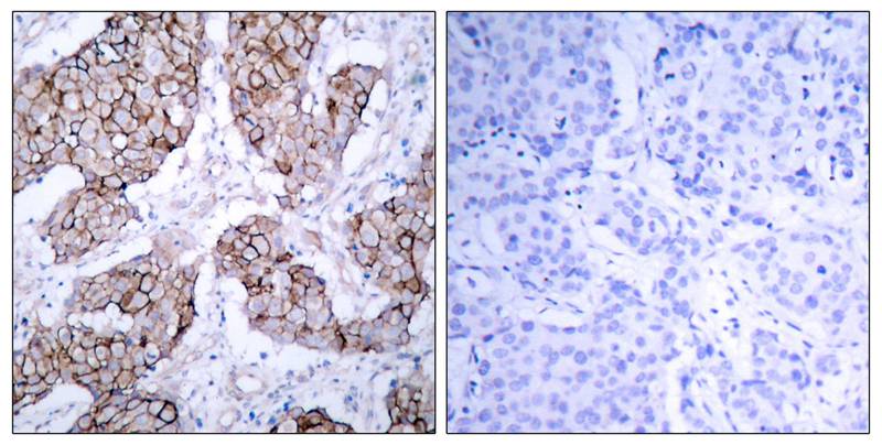 EGFR [p Tyr1092] Antibody - BSA Free