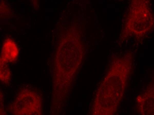 eIF2A [p Ser51] Antibody