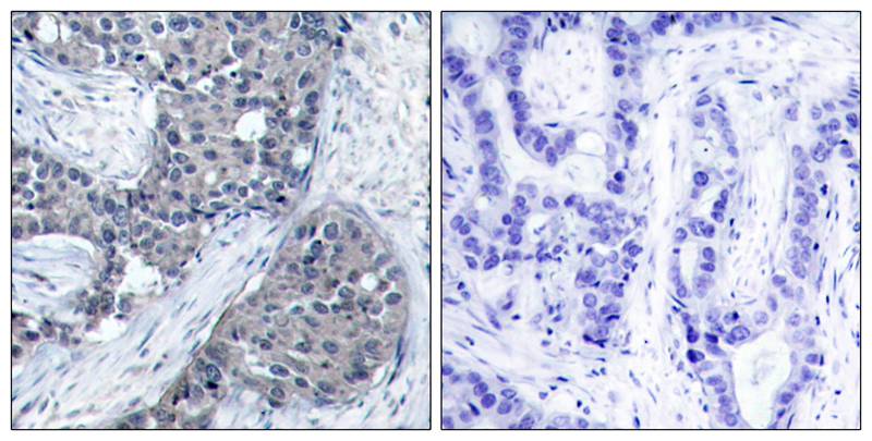 eIF4E [p Ser209] Antibody - BSA Free