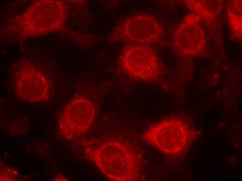 eIF4E [p Ser209] Antibody - BSA Free