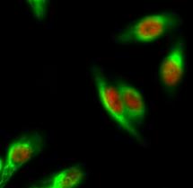 ER alpha/NR3A1 Antibody