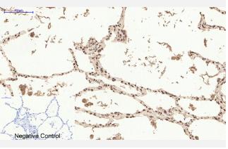 ER alpha/NR3A1 Antibody