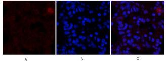 ER alpha/NR3A1 Antibody
