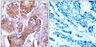 ER alpha/NR3A1 [p Ser106] Antibody