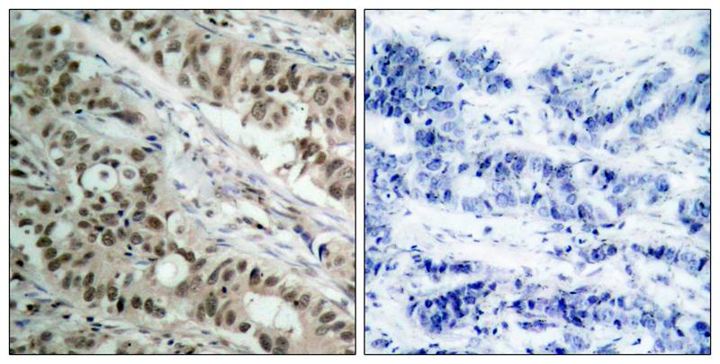FoxO1/FKHR Antibody - BSA Free