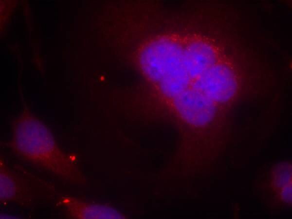 FoxO1/FKHR Antibody - BSA Free