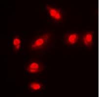 FoxO1/FKHR [p Ser256] Antibody