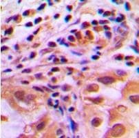 FoxO1/FKHR [p Ser256] Antibody