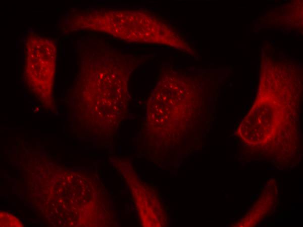 FOXO3 [p Ser253] Antibody