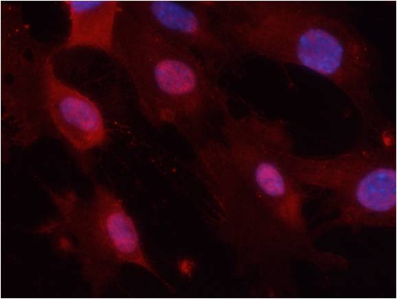 GSK-3 beta [p Tyr279, p Tyr216] Antibody - BSA Free