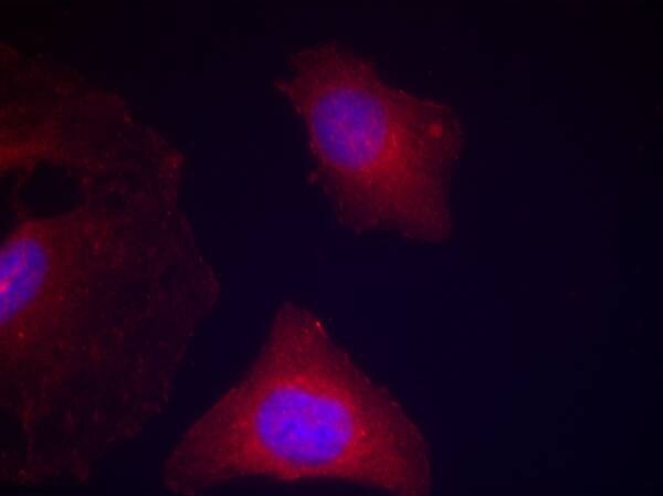 GSK-3 beta [p Tyr279, p Tyr216] Antibody - BSA Free