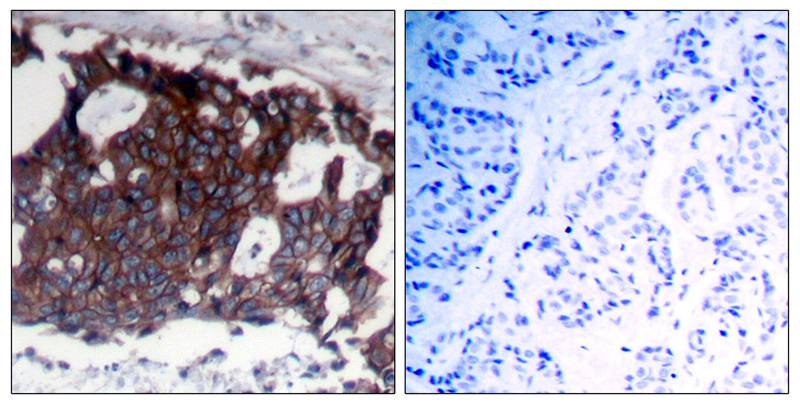 ErbB2/Her2 Antibody - BSA Free