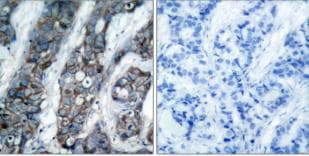 ErbB2/Her2 [p Tyr1248] Antibody