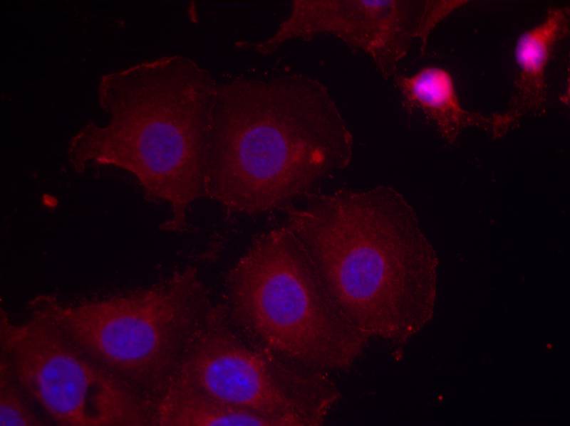 ErbB2/Her2 [p Tyr877] Antibody - BSA Free