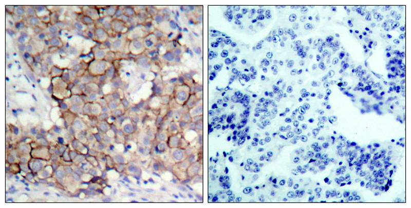 ErbB2/Her2 [p Tyr877] Antibody - BSA Free